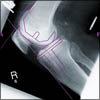 Ortho